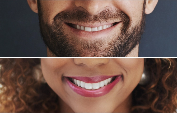 What to Expect After Teeth Whitening Treatment?