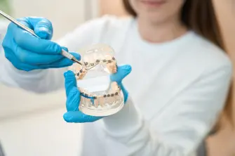 Invisalign