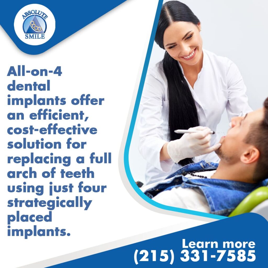 all-on-4 dental implants