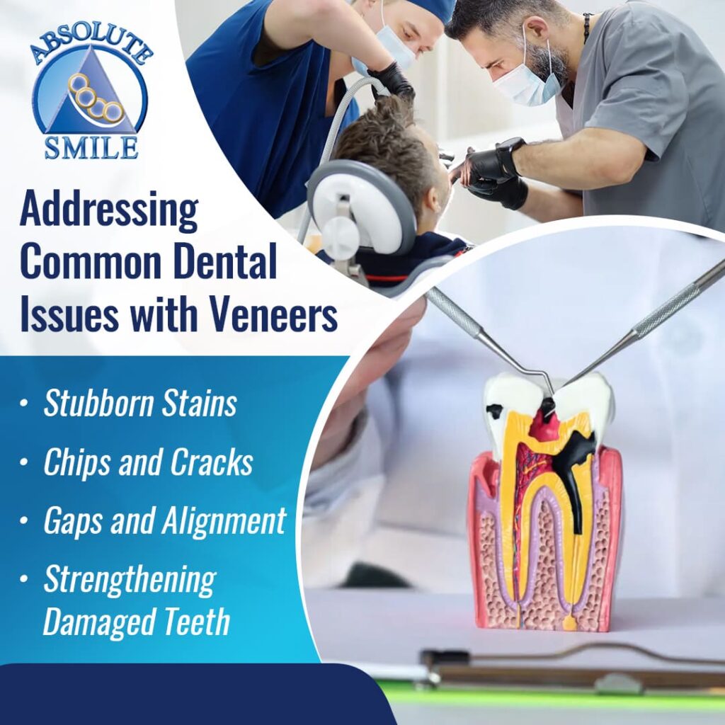 Addressing Common Dental Issues with Veneers