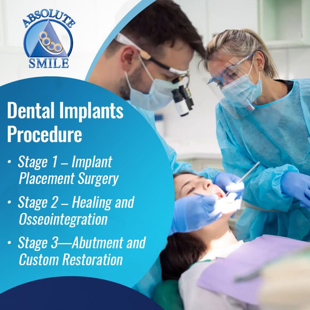 Dental Implants Procedure