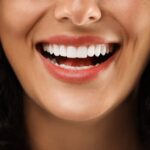 Closeup View of Smiling Woman. Dental Veneers