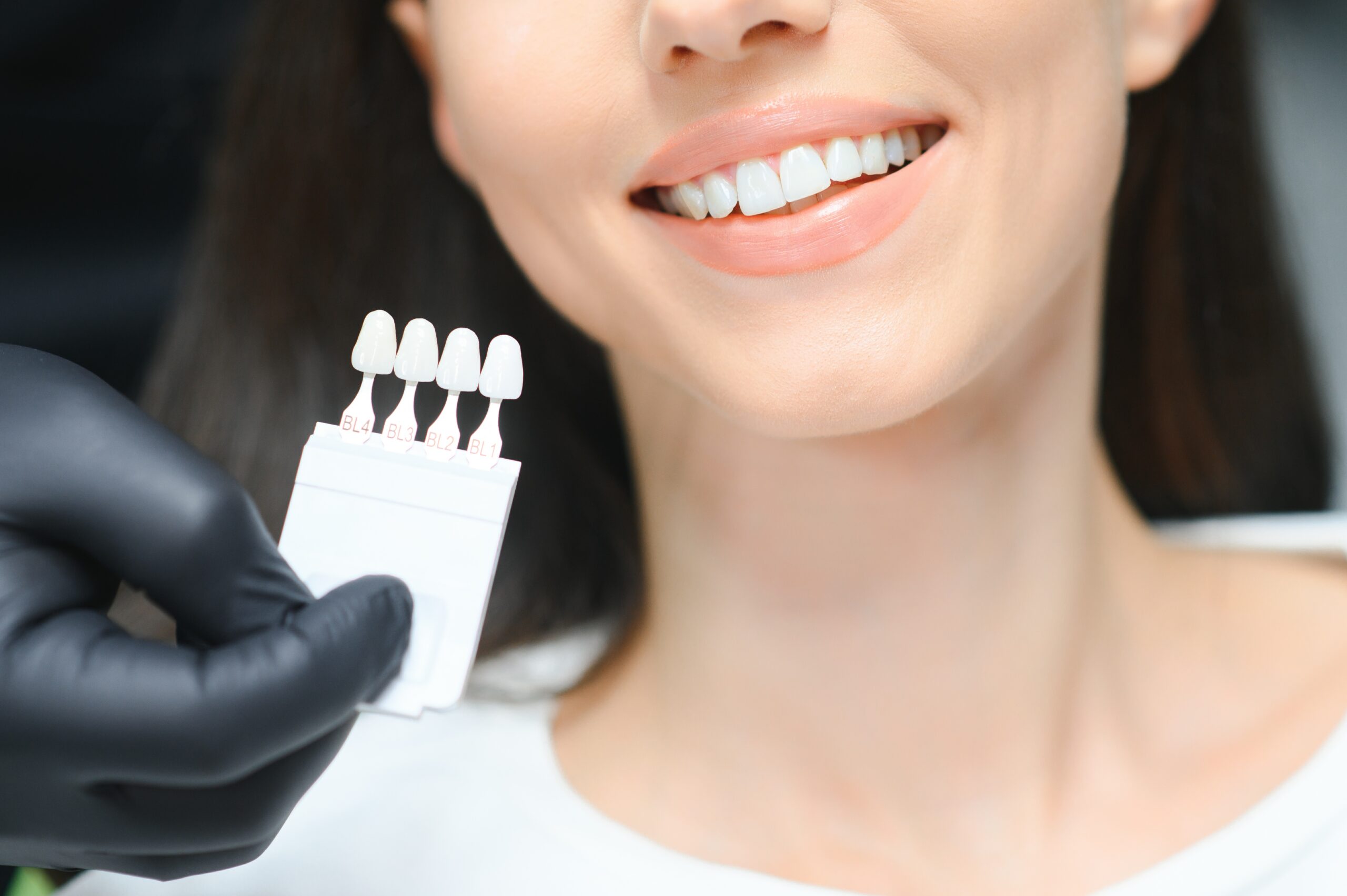 veneers philadelphia pa Close-up of a smiling woman at a dental clinic undergoing a veneer shade selection process. A dentist wearing black gloves holds a shade guide to match the perfect veneer color for a bright, natural-looking smile.